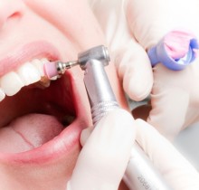 Профессиональная чистка зубов - Стоматологическая клиника ПрезиДентПлюс г.Екатеринбург